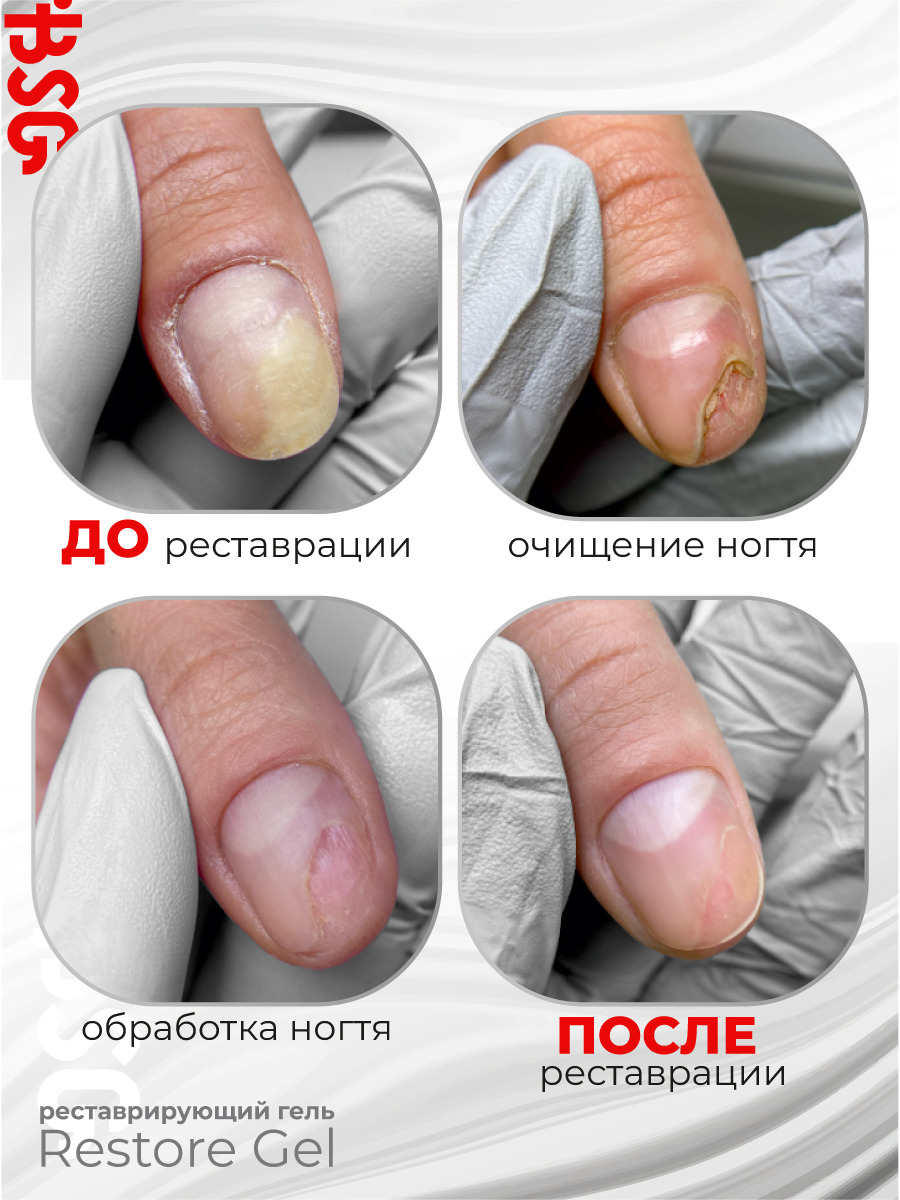 RESTORE_GEL_доп_4